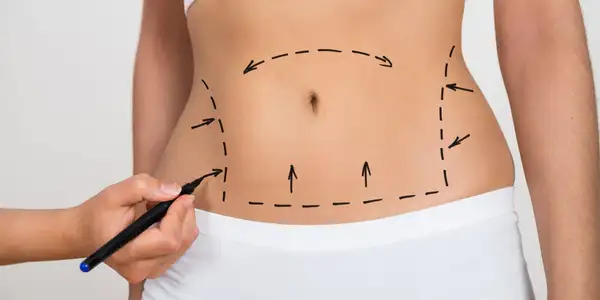 Body cosmetic surgery procedures